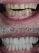 Slider image (4) Smile Atelier by Dr. Roberto Tamara - Dental Clinic in Colombia